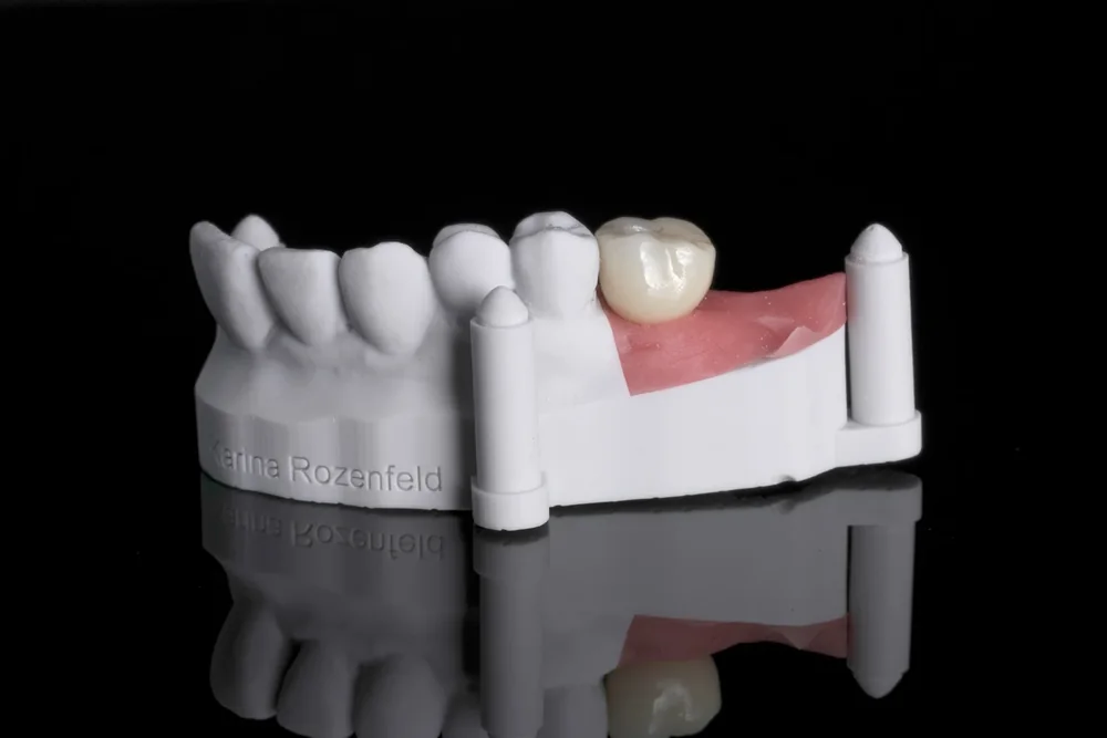 Zirconia crown on a 3D-printed dental model